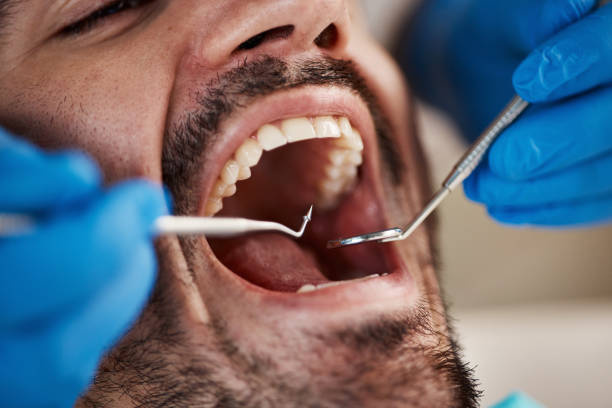 Best Emergency Dental Care for Abscessed Tooth in Oceano, CA