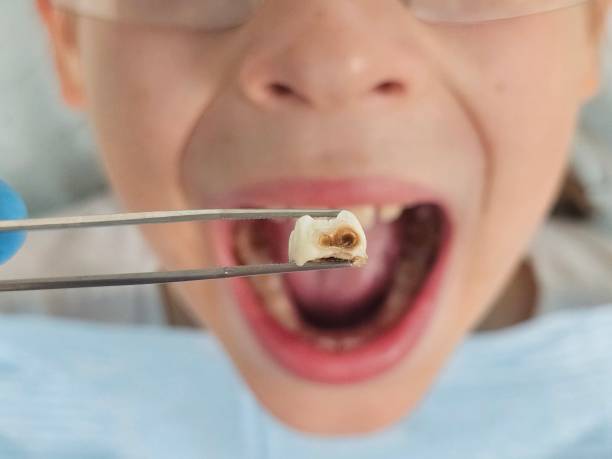 Best Urgent Dental Care for Toothache in Oceano, CA